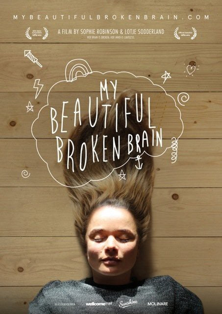 1000 piece jigsaw puzzle for tv poster: My Beautiful Broken Brain